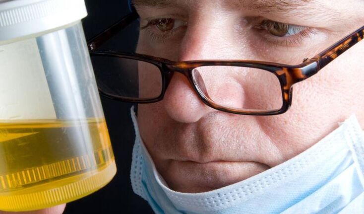 analiza urinei pentru prostatita cronica