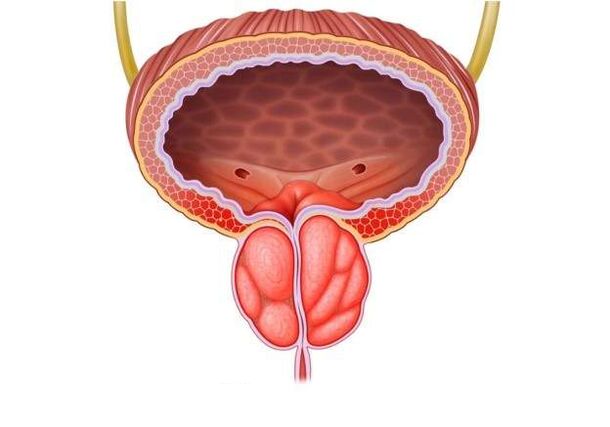 tratamentul prostatitei la bărbați